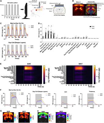 Impaired Local and Long-Range Brain Connectivity and Visual Response in a Genetic Rat Model of Hyperactivity Revealed by Functional Ultrasound